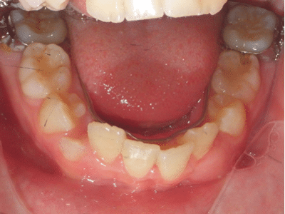Picture1