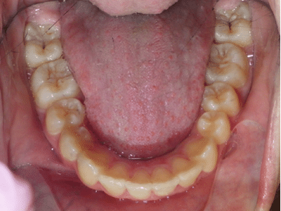 Picture2